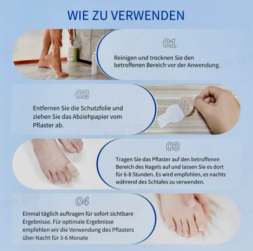 Nagelpflaster gegen Nagelpilz