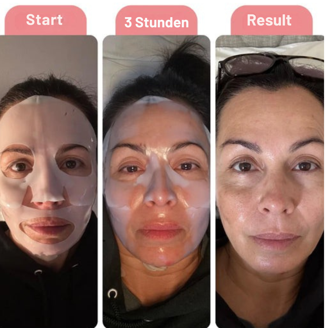 BIO KOLLAGEN-MASKE™