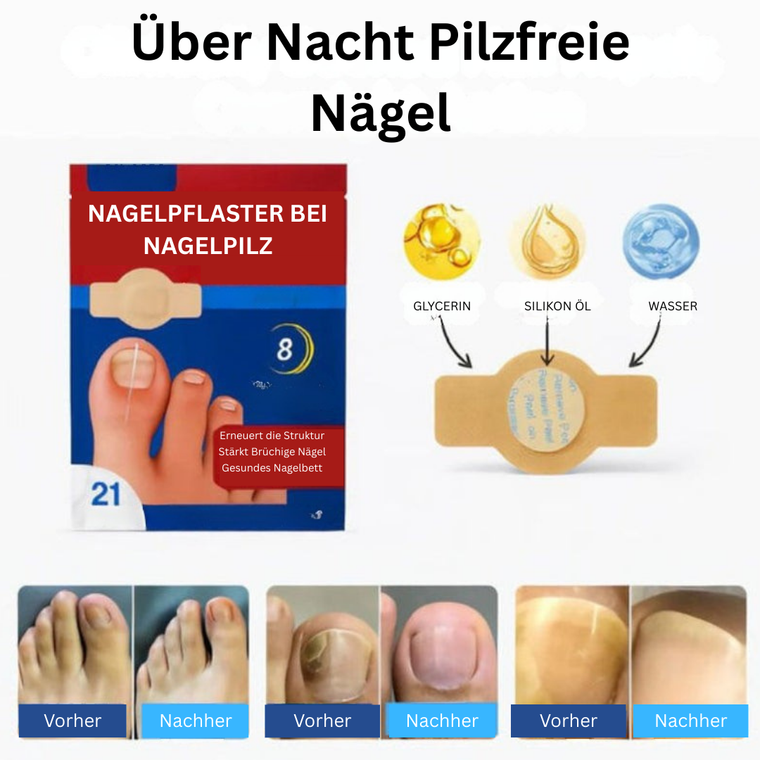Nagelpflaster gegen Nagelpilz